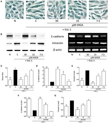 Blockade of Eosinophil-Induced Bronchial Epithelial-Mesenchymal Transition with a Geranyl Acetophenone in a Coculture Model